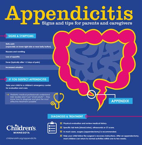 How is life different without an appendix?